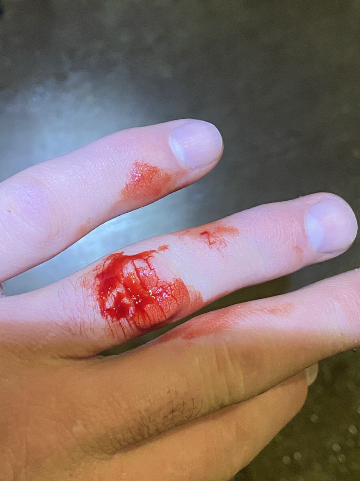 Bite